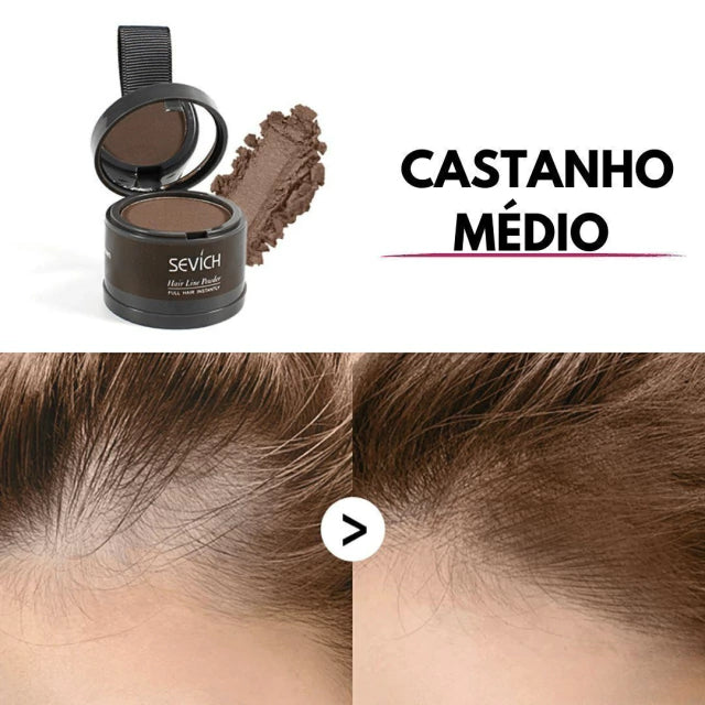 Sevich - Cobre os Fios Brancos e Falhas Capilares